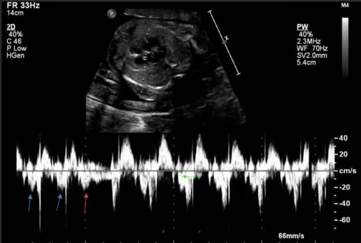 Congenital Cardiology Today tweet media