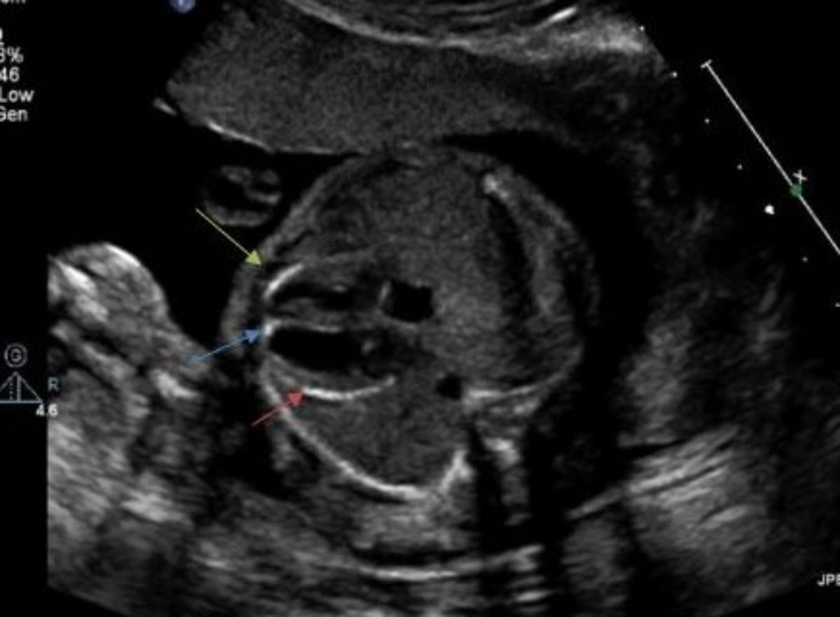 Congenital Cardiology Today tweet media