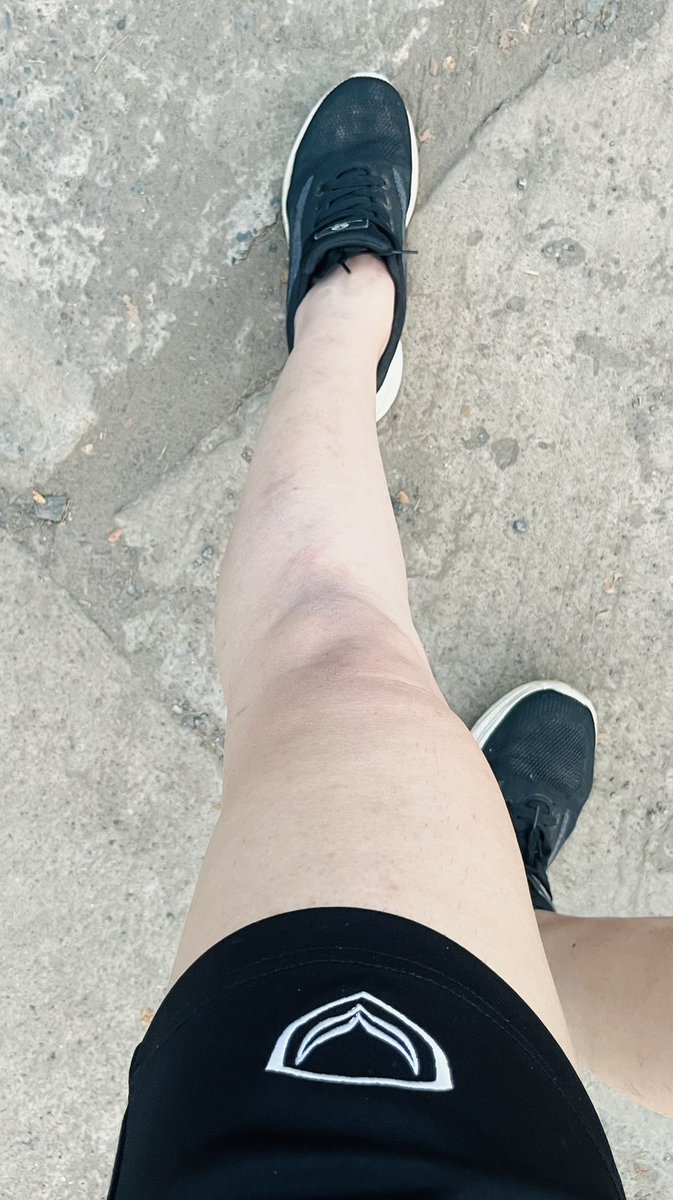 ป.ปลาตากลม ผมยาว tweet media