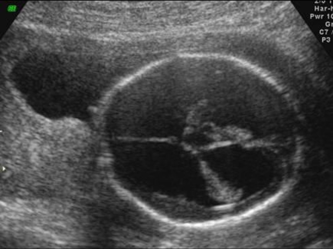 RadiographyNG☢️ tweet media