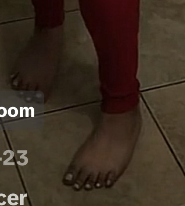 Hi_Im_Coke's tweet photo. This a white bitch btw with BLACK ASS FEET 🤣 yall never seen my feet look like this before https://t.co/HvsSKPmvTm