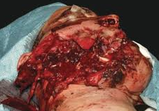 Magnesium Carlos tweet media