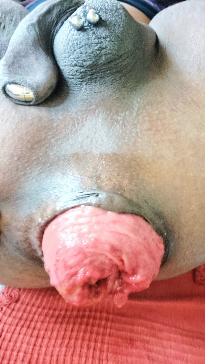 A quick rose check after the apple incident, no more discomfort #prolapsedcunt