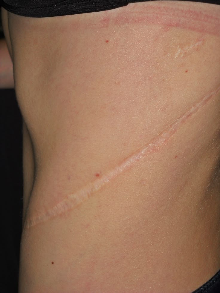 ☆ Корен / Koren tweet media