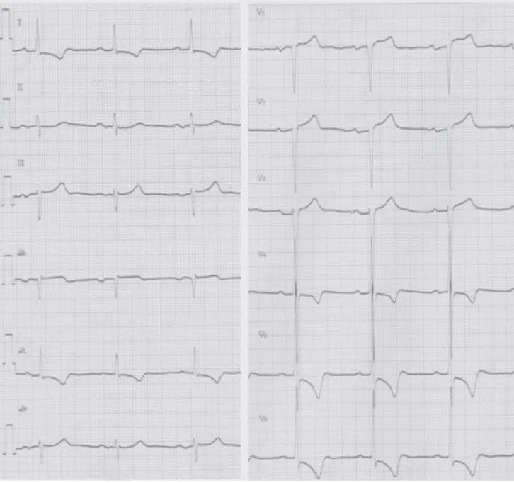 心電図くま | ECG KUMA tweet media