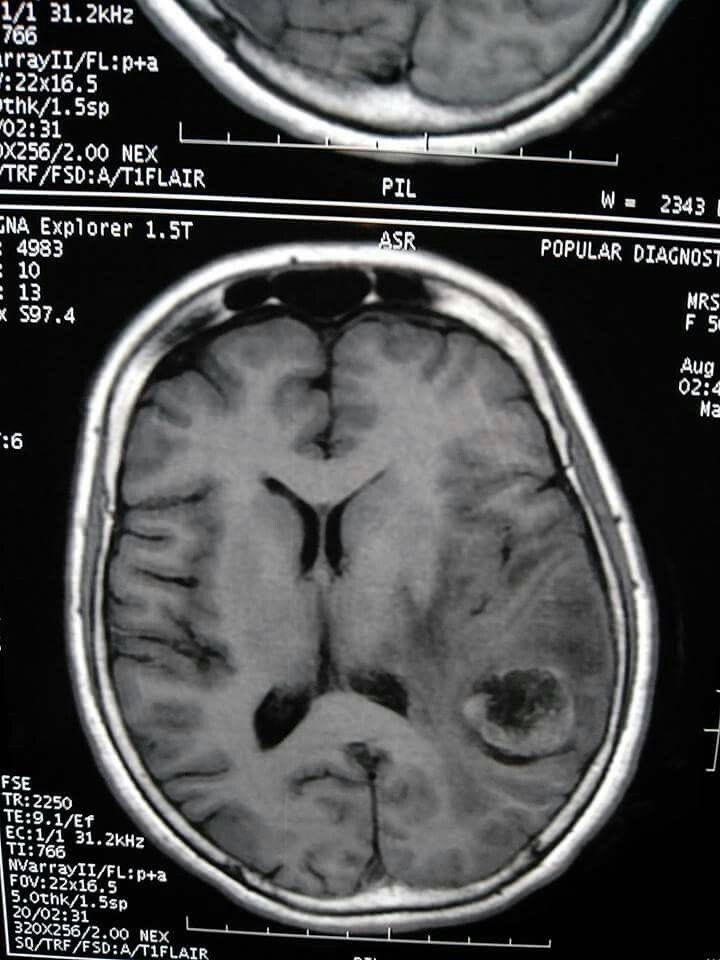 Alfred 🏄🏻‍♀️ tweet media