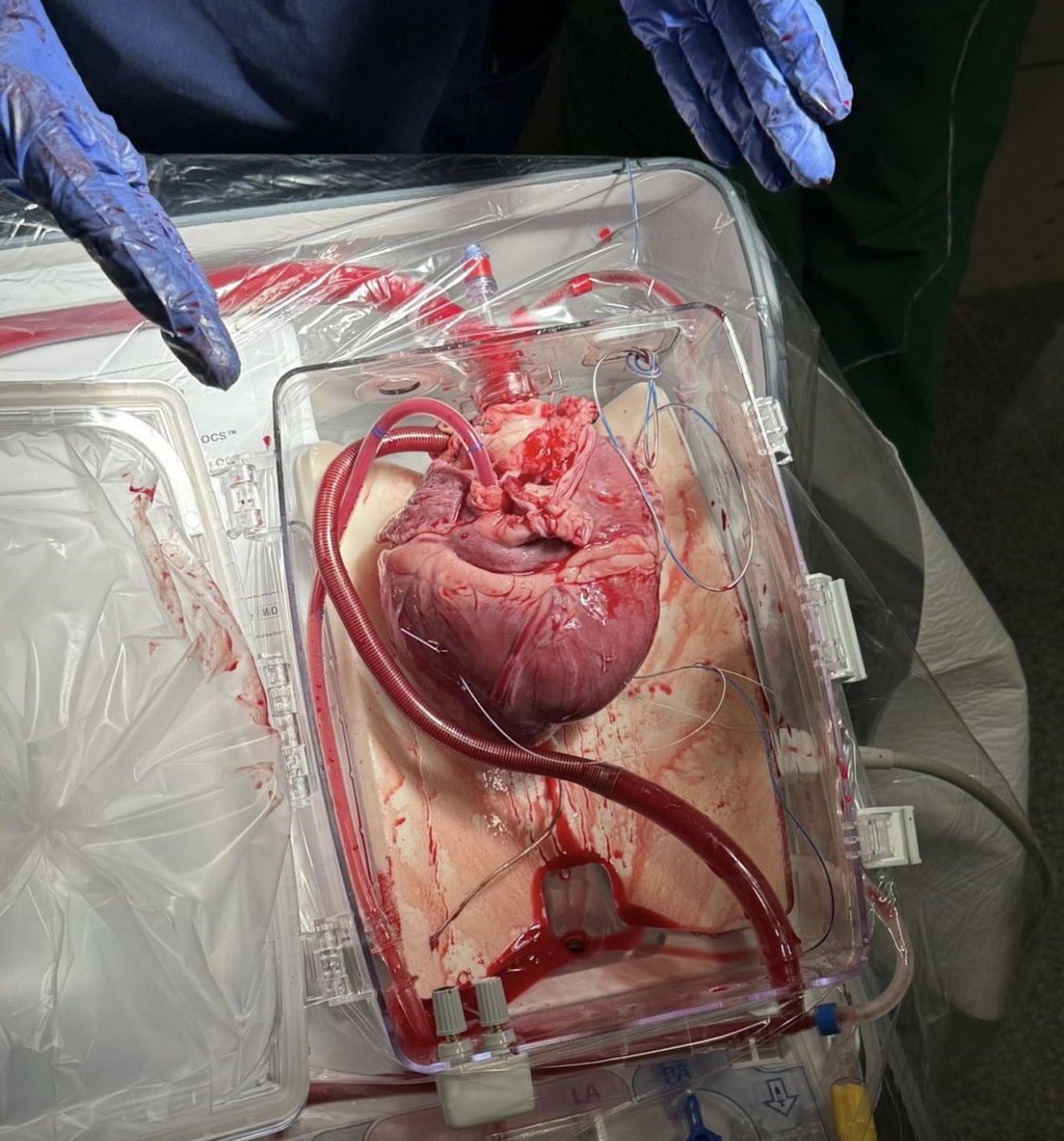 Jonah Lupton tweet media