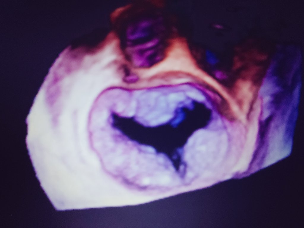 Benoy Shah MD tweet media