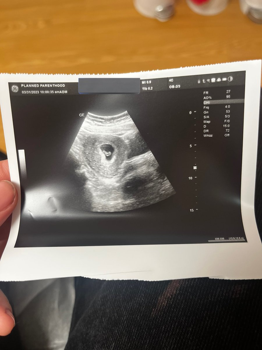 big headass bong yoda tweet media