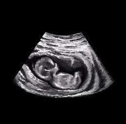 lane 🧸 (-8/10) tweet media