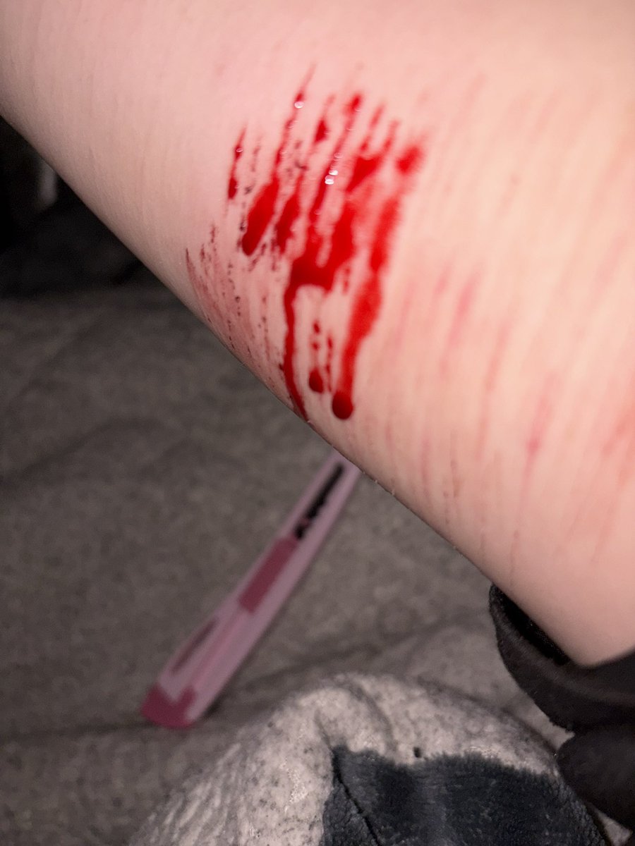 아람이 tweet media