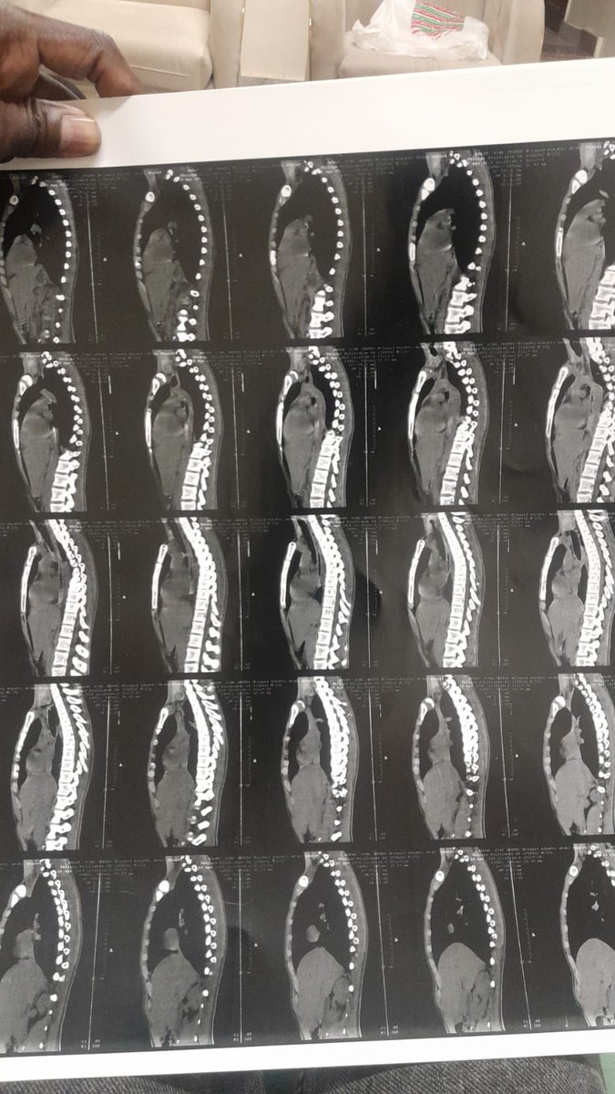 مساء الخير 
عندنا شاب عمرو ١٩ سنة مصاب عمليات حصل ليهو شلل وقيمة العملية ١٢٥ الف جنيه مصري قدر صاحبه يجمع ليهو مبلغ ٥٠ الف من جملة المبلغ المطلوب 
اتعهد انا بتسليمه شخصيا اي مبلغ يوصلني 
رجاء محبة رسلوا لي الأشعار في 
00249912500655 
رقم الحساب 
 1190597
جينا جوزيف 
#حوجة_عاجلة