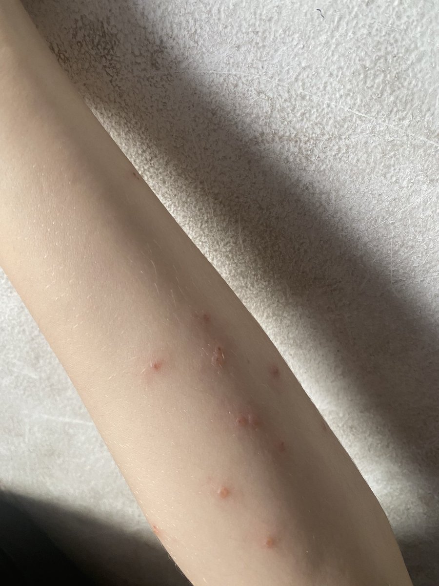 Mahmoud Mohammed🍉🍉 tweet media