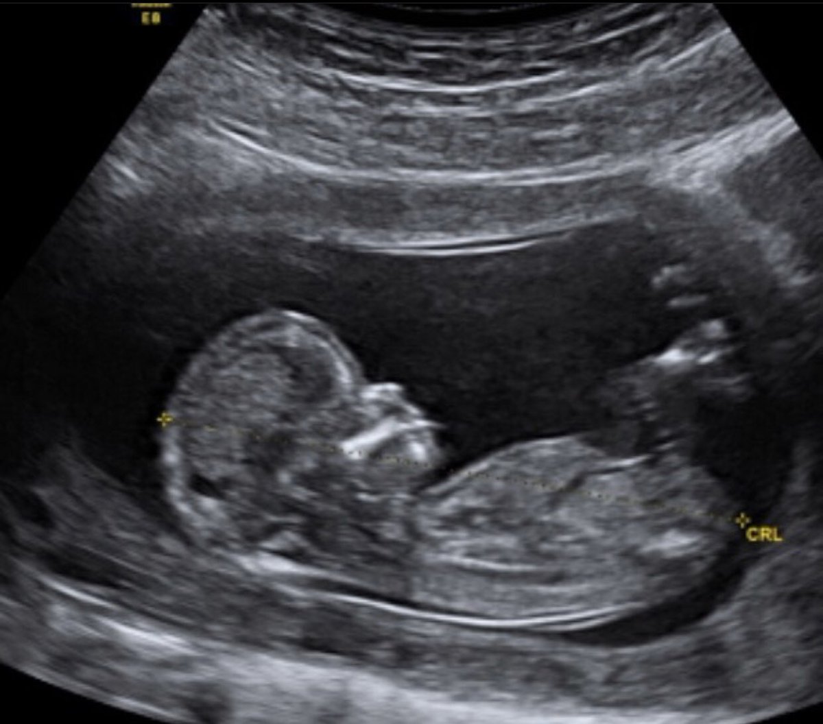 Quan DING DING 👩🏻🎨👩🏻🏫👩🏻💻 tweet media