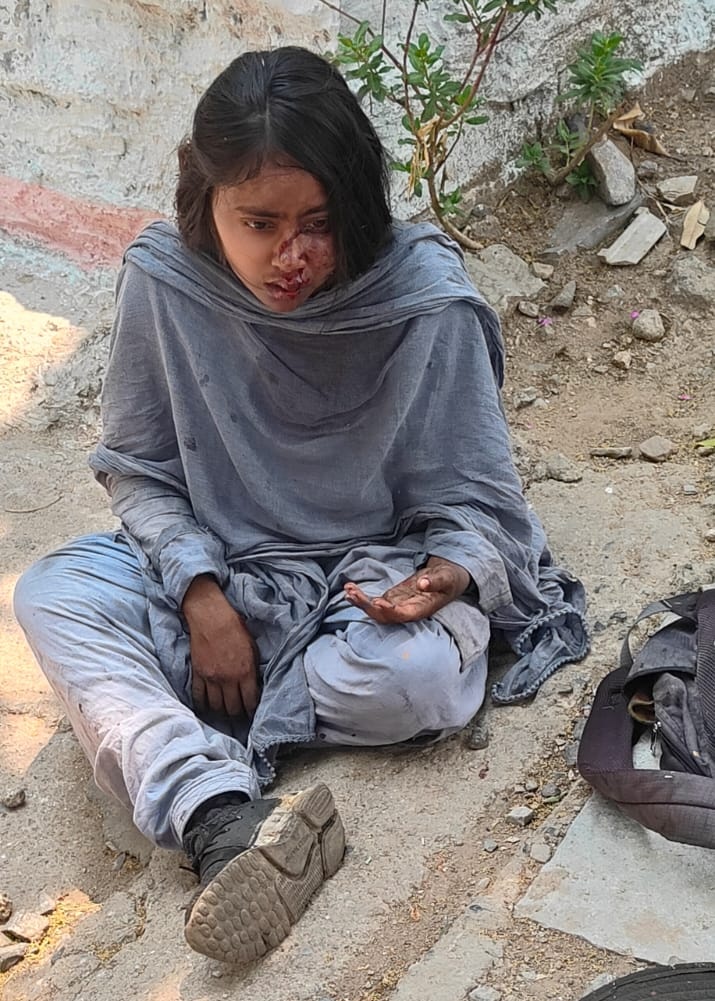 SSE/PW/SEM के अंतर्गत काम करने वाली कर्मचारी, कुमारी प्रियंका, आज 38/1 से 5 के बीच अकेले ड्यूटी पर थीं। उस दौरान, सुरक्षा का कोई इंतज़ाम न होने का फ़ायदा उठाकर,जानलेवा हमला किया और उनके साथ बलात्कार करने की कोशिश की l संज्ञान लिया जाए <a href="/AshwiniVaishnaw/">Ashwini Vaishnaw</a> <a href="/RailMinIndia/">Ministry of Railways</a> <a href="/gmscrailway/">General Manager,South Central Railway</a>