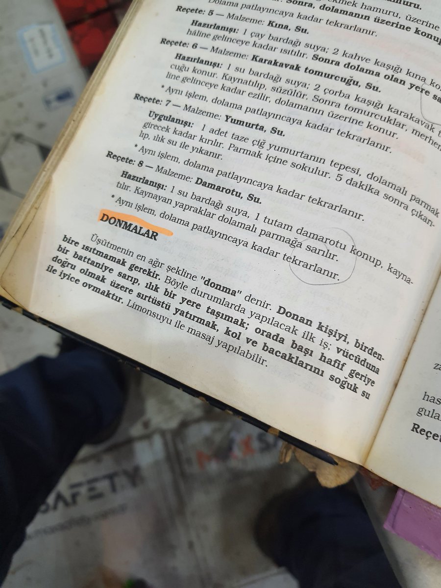 Hastalıklar 
Donma, Donma Tehlikesi, Donmalar
..

Merkez Bankası, Sandık, Keller, Yapın