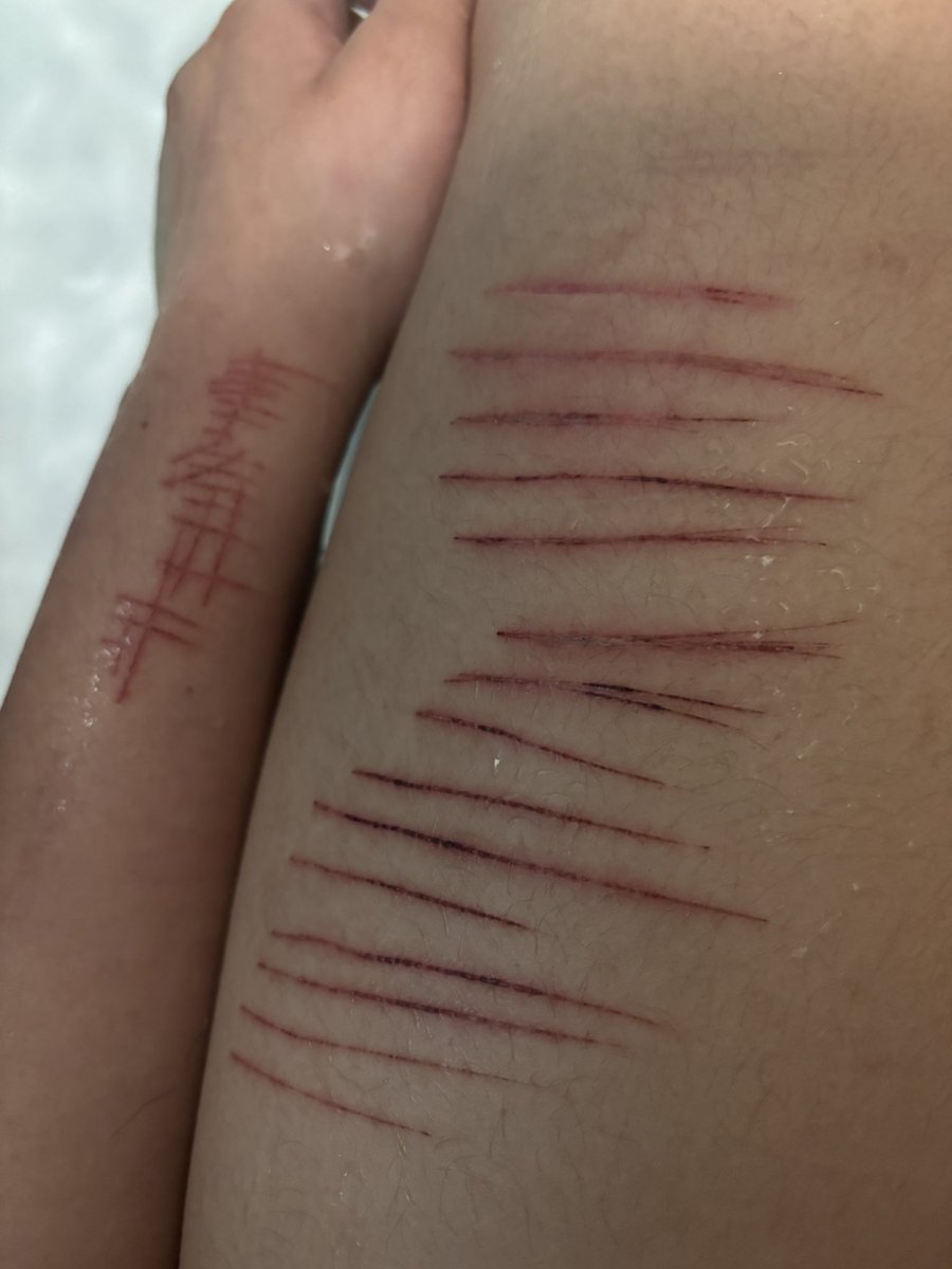 ♱Fyodor of normaltwt ୭ ˚. ᵎᵎ tweet media