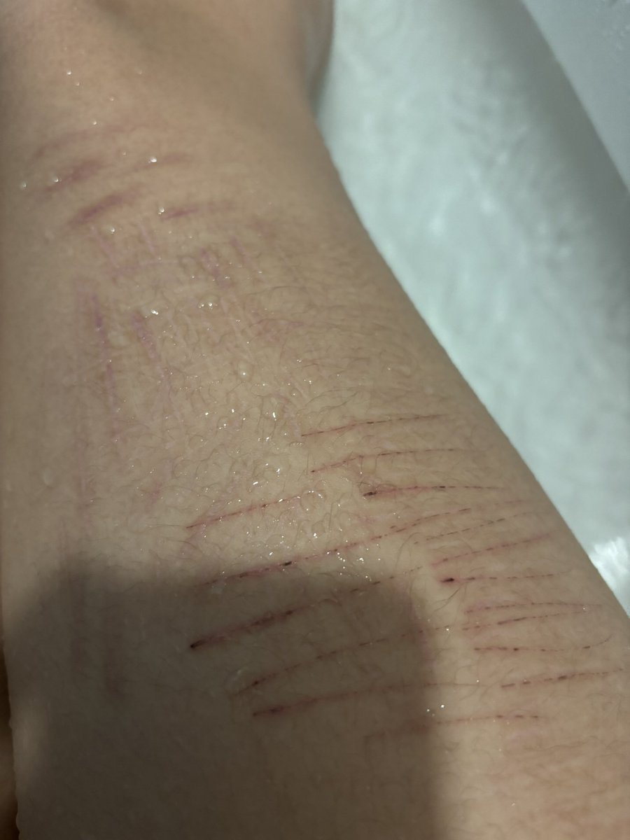 ♱Fyodor of normaltwt ୭ ˚. ᵎᵎ tweet media