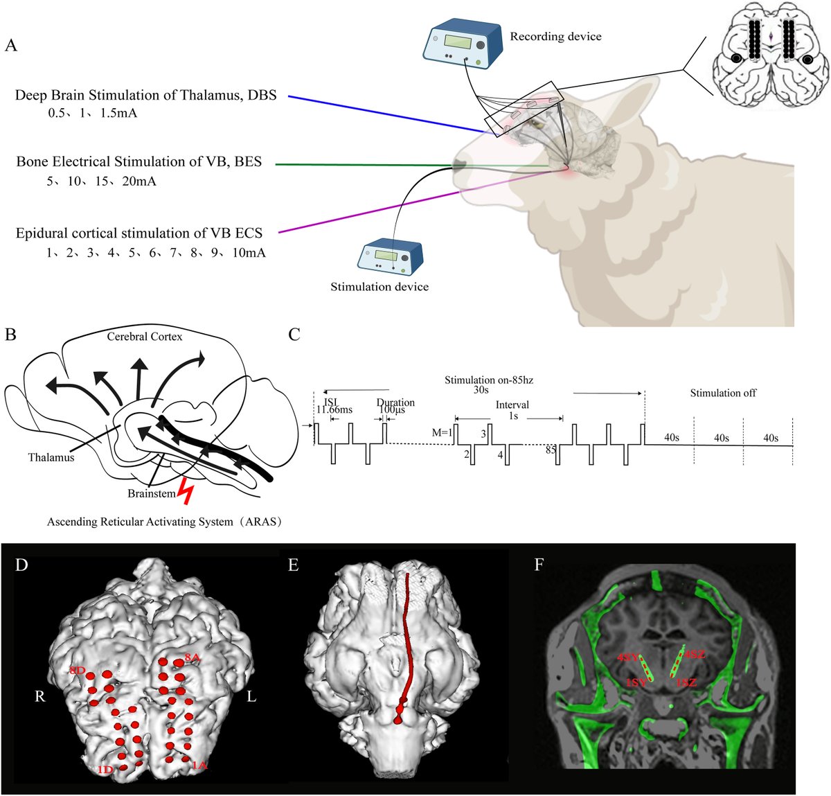 Brain Stimulation tweet media