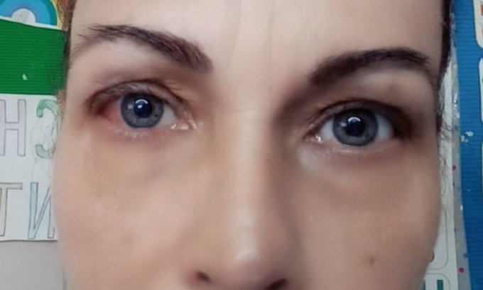 Zamalek2 🍺🍀💋 tweet media