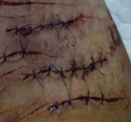 𝒽𝒾𝓀𝒶𝓇𝓊 𝑜𝒻 𝓈𝒽𝑒𝒹𝓉𝓌𝓉 (˶˃𐃷˂˶) tweet media