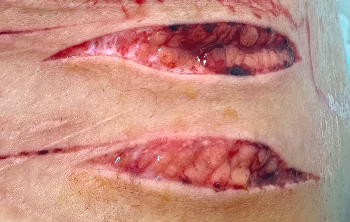 𝒽𝒾𝓀𝒶𝓇𝓊 𝑜𝒻 𝓈𝒽𝑒𝒹𝓉𝓌𝓉 (˶˃𐃷˂˶) tweet media