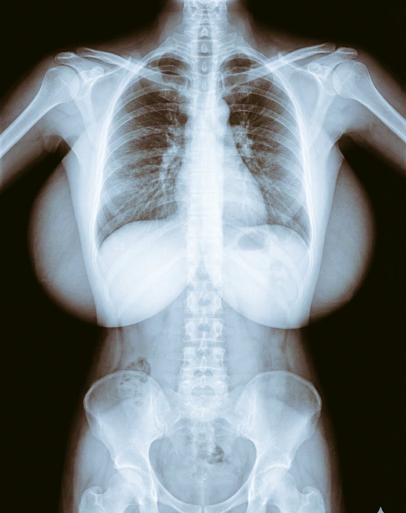 Vanilla aristya tweet media