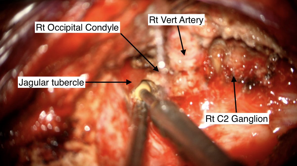 Gmaan Alzhrani MD, FRCSC. tweet media