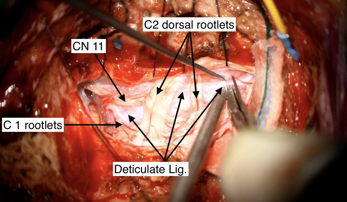 Gmaan Alzhrani MD, FRCSC. tweet media