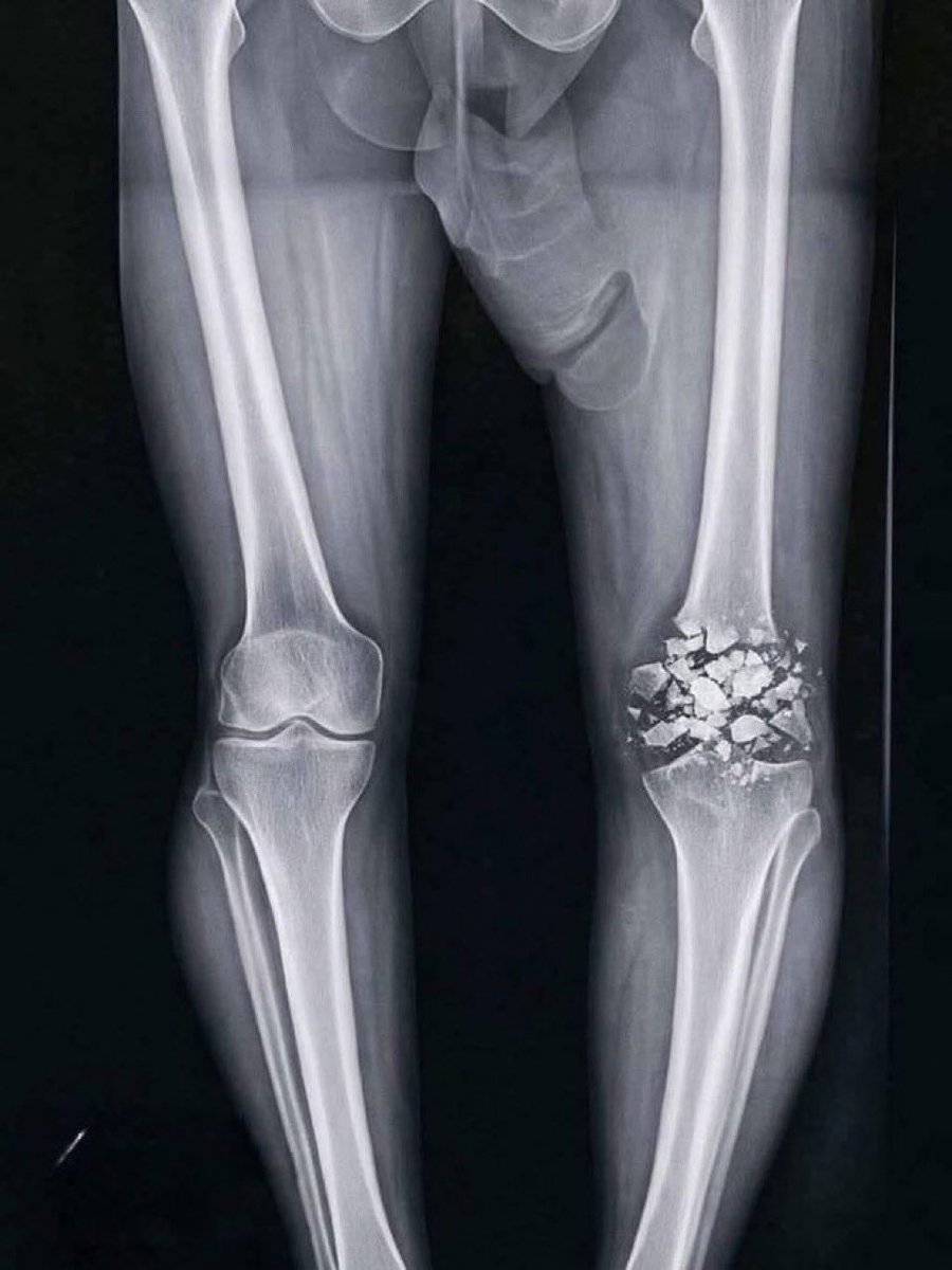 adriano | Nummer 1️⃣ in Franken tweet media