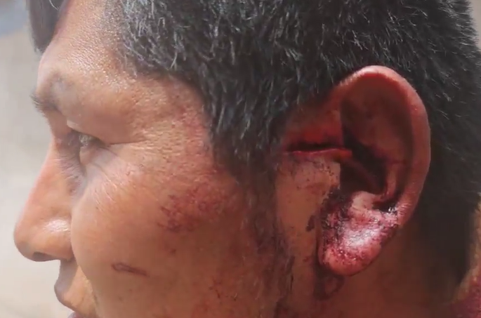 Mataperrea tweet media