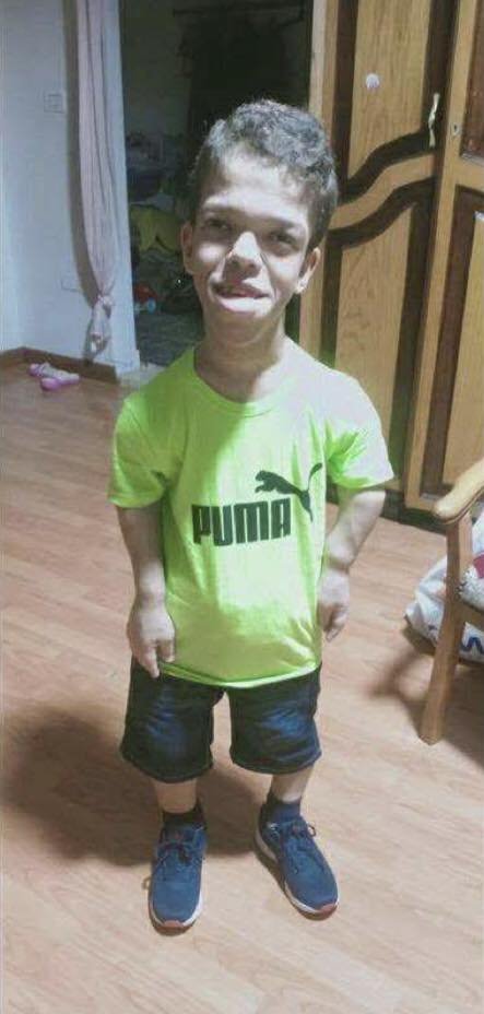 محمد وليد محمد عبد المنعم
مواليد 2006، تم اعتقاله في2024 بتهمة تولي قيادة بجماعة إرهابية وتمويلها!!
محمد من ذوي الاحتياجات الخاصة ومُصاب بخلل في العمود الفقري واعوجاج به، وإعاقة في الذراع الأيسر والقدم اليسرى، وكِبَر في حجم الجمجمة وضمور في القدم اليسرى، وضعف في القلب والرئتين!