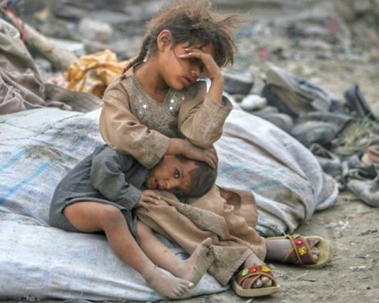 Yemen Starving tweet media