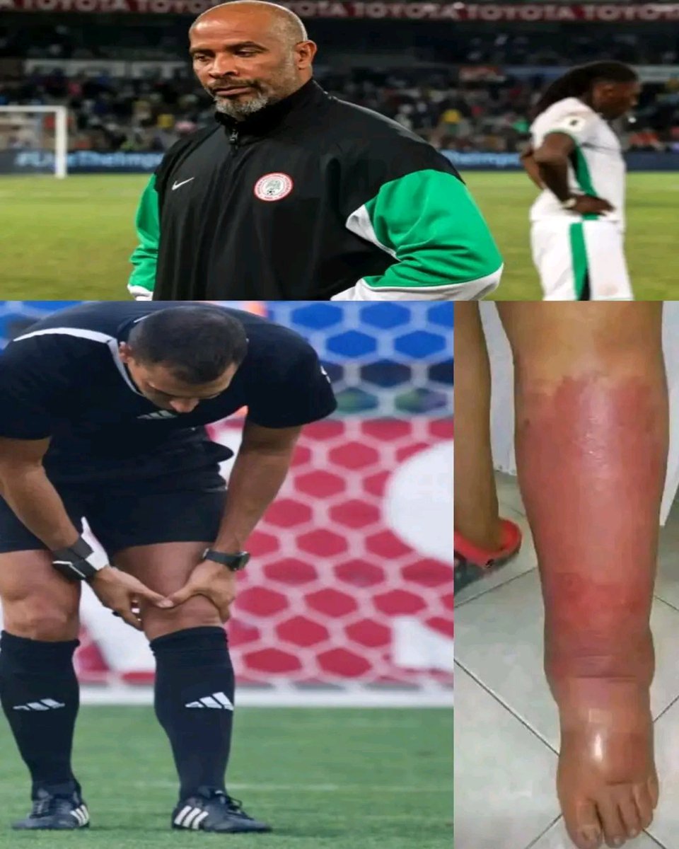 Faux Tête  🇨🇩 tweet media