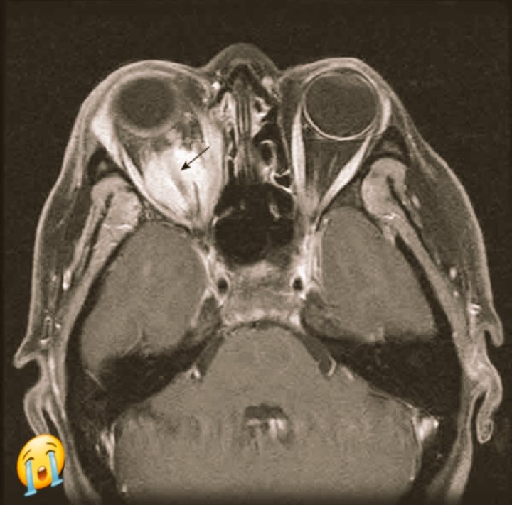 Amaris Irina Junco Balon tweet media