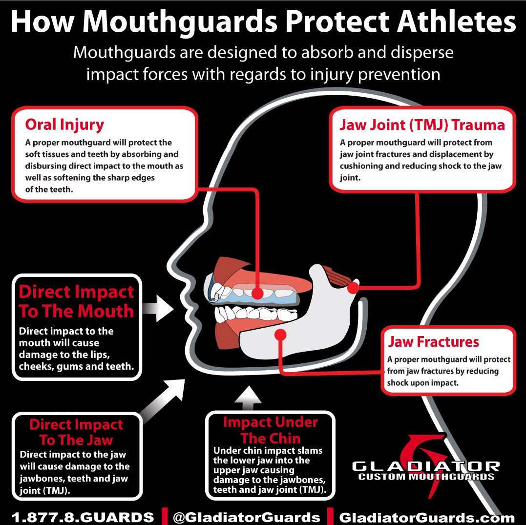 Gladiator Custom Mouthguards tweet media