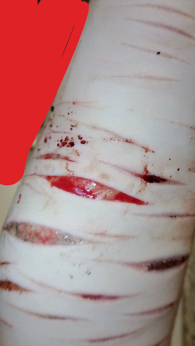 Simon of shedtwt tweet media