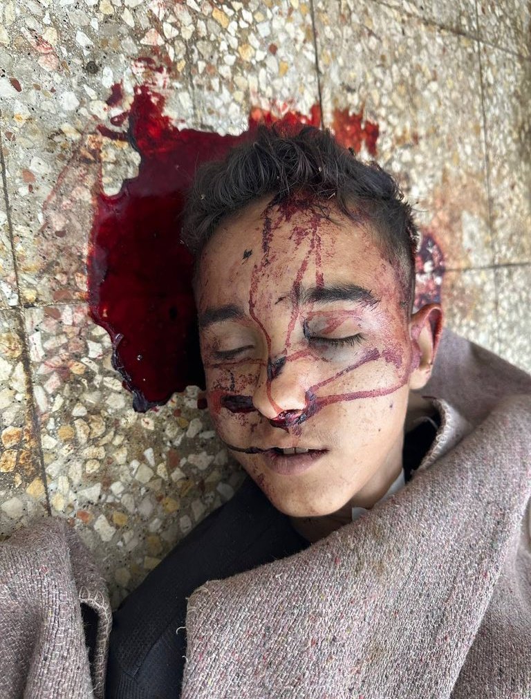 Yemen Starving tweet media