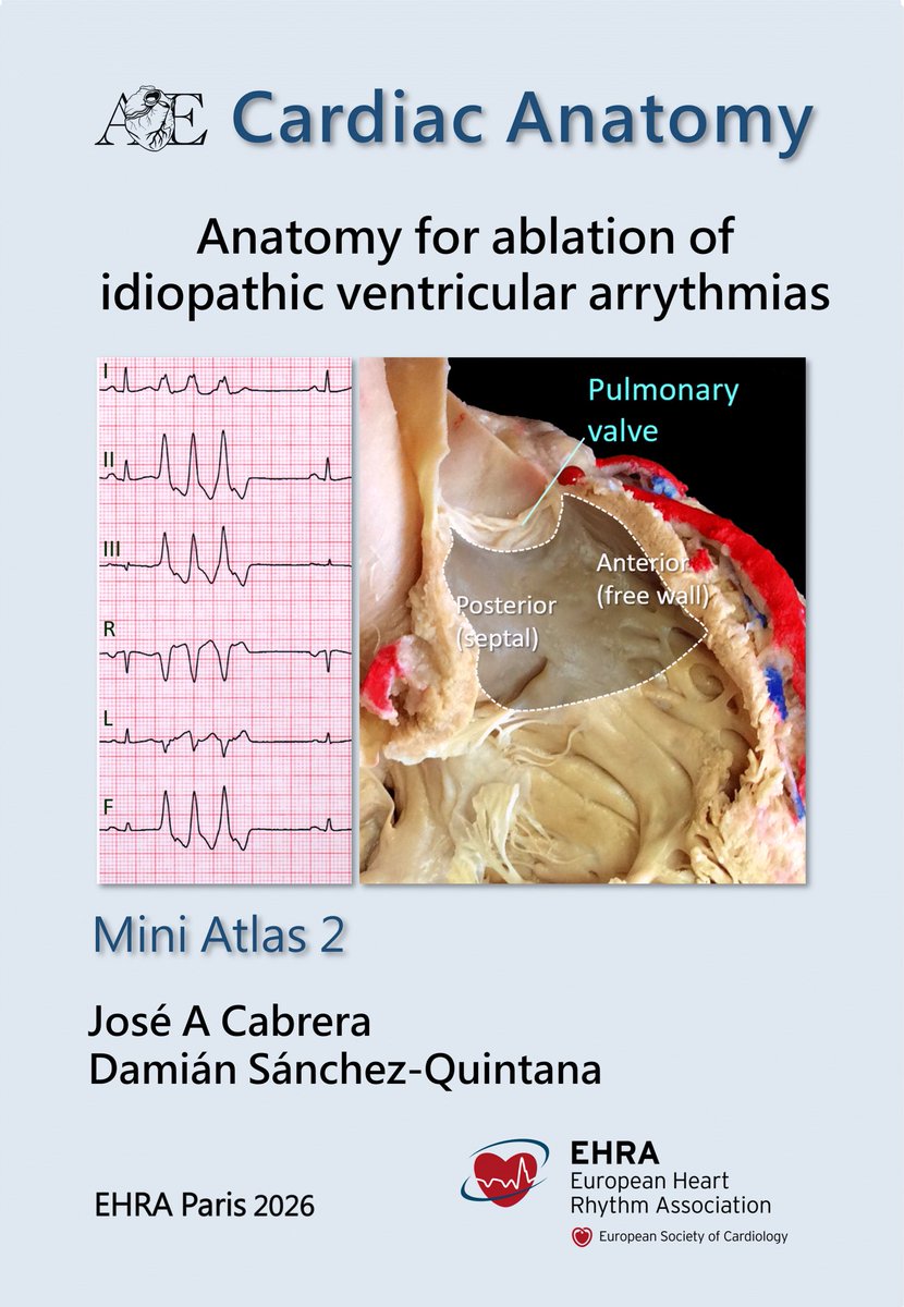 jacabreracardio's tweet photo. EHRA 2026 – Paris 🇫🇷
Cardiac Anatomy Workshop
Join us for a hands-on session with real cardiac specimens.

🎁 We will give away both Mini Atlases:
• General Cardiac Anatomy
• Ventricular Anatomy

Monday 13 April 2026 – Room 7
@cardiac_anatomy 

https://t.co/pcXGLSJNYy https://t.co/apmJjo5Oua