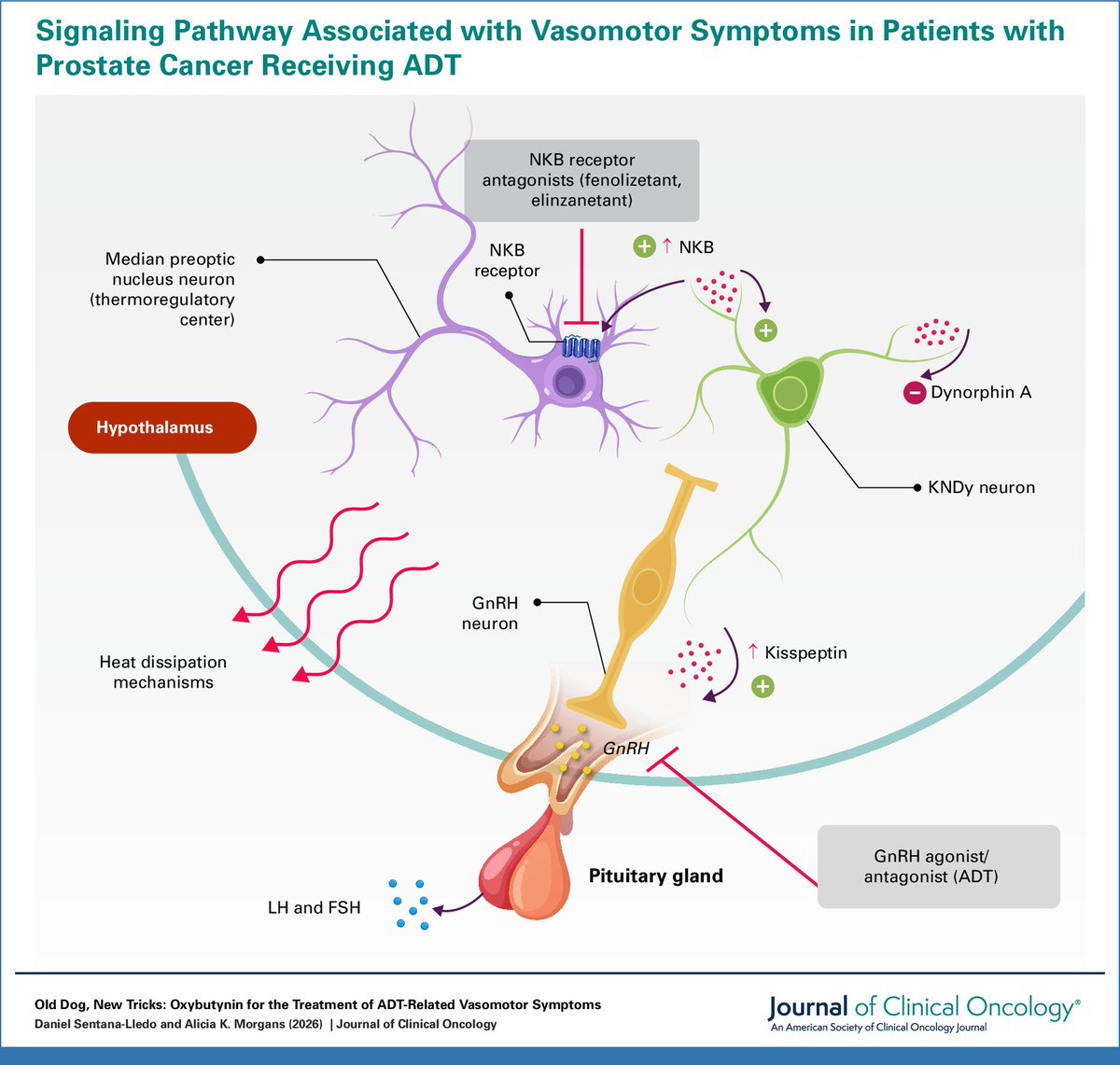 DrYukselUrun's tweet image. Hot flashes affect most men on ADT!
We've lacked good options. Oxybutynin, an old drug, may change that. 
The NKB pathway shows us why. 🔥 @CaPsurvivorship @ASCO @JCO_ASCO @OncoAlert @OncBrothers @APCCC_Lugano #prostatecancer
DOI: 10.1200/JCO-26-00144