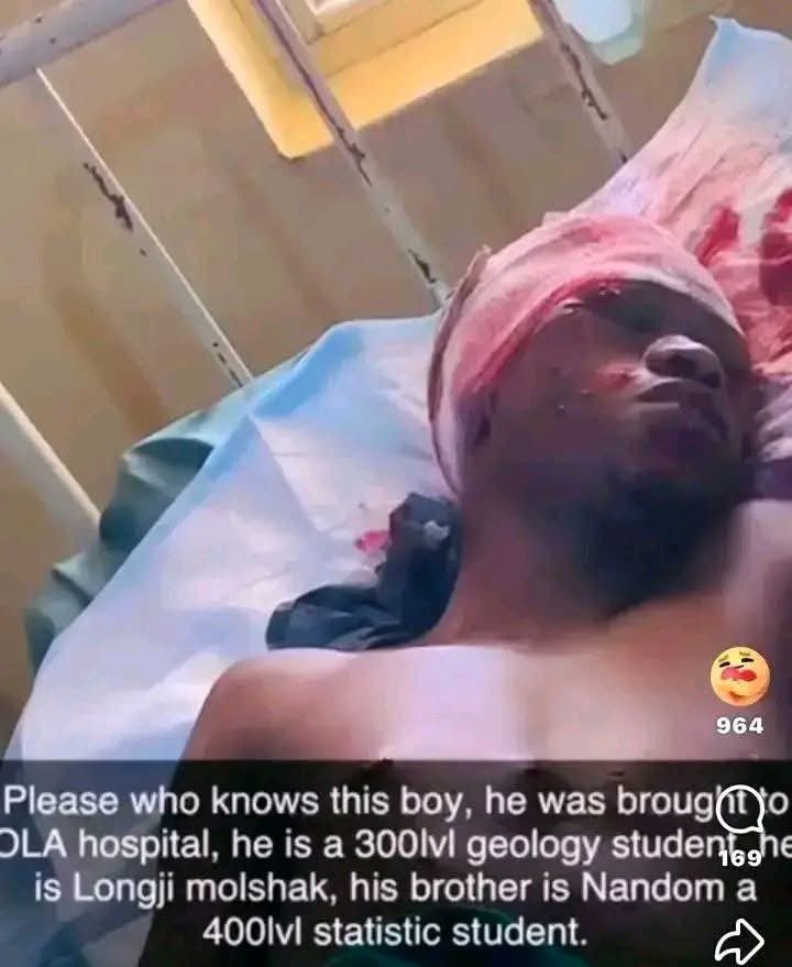 DrCroc28's tweet photo. Wow! This student that was attacked today at Uni Jos survived, his name 
Is Longji Molshak.

He need serious medical attention, I hope he doesn’t suffer from serious internal bleeding the way they were heating his head with stone and planks.

Fortunately  he survived. He is a 300-level Zoology student presently undergoing treatment at the hospital. 

I wish I can be in Jos tonight to donate my blood for him. Please, and tag his relatives, I pledge N50k for his treatment.

There are 2 individuals willing to givedonate for his treatment.

Please, reach out inbox