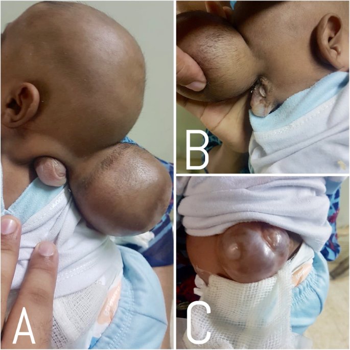 Dr Abdul Hameed 🩺 tweet media