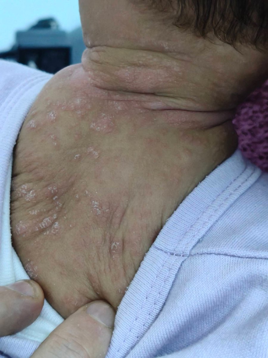 alaa alaa tweet media