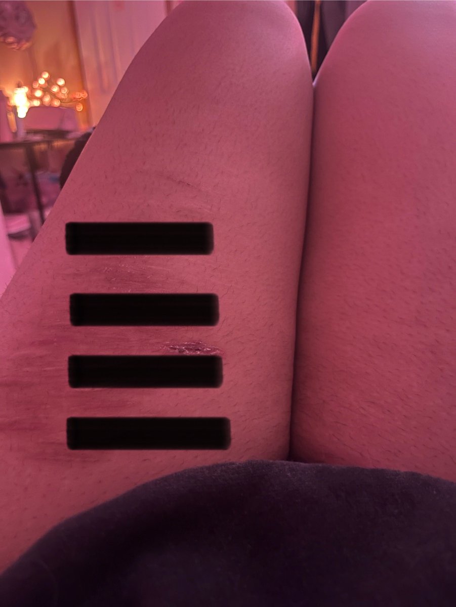 || Band-aid of shtwt 🩸 tweet media