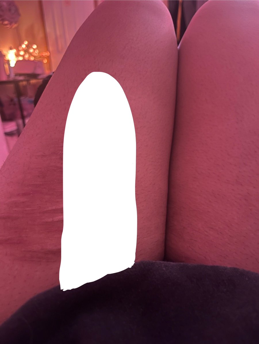 || Band-aid of shtwt 🩸 tweet media