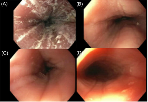 JPGN Reports tweet media