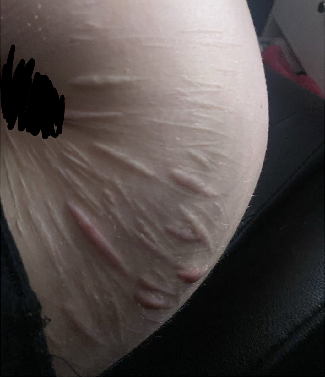 charlie | sh + ed recov tweet media