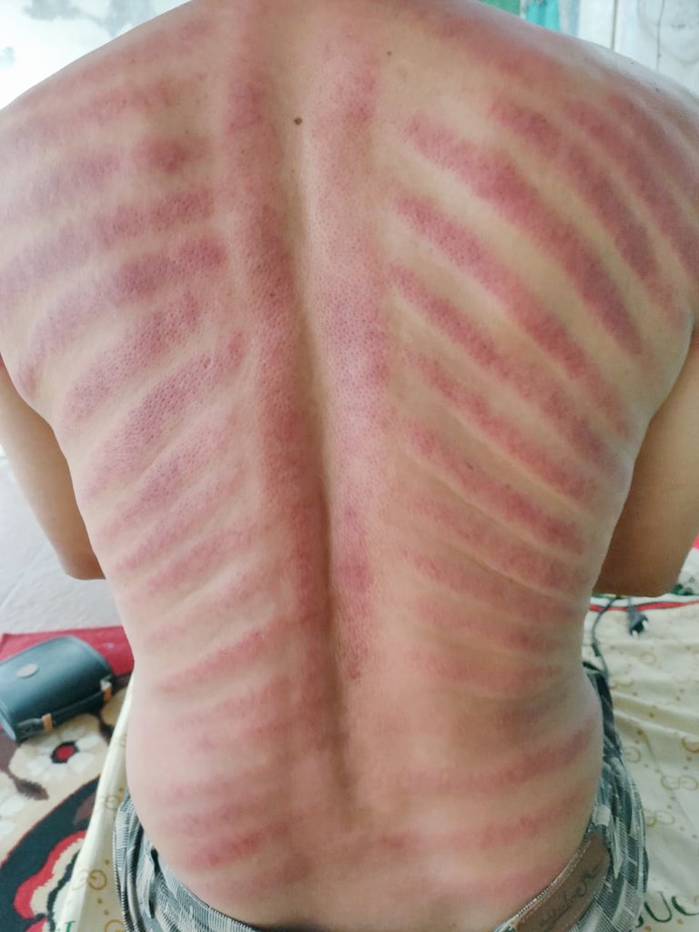 Raditya130582's tweet photo. REAL #rileksasi (pijat capek/kerokan/luluran/bodyscrub) hnya PANGGILAN, area SOLO 85rb. Minat👉🏻☎️ 085695070716, dijamin bukan abal².
Terima kasih @Allan212121 @agungrifansyah @pjt_amatir_cmh @ragasalira_ @tattoopak @Sieroromeo @Telogedde @frmnl0ve_pjt @Guntur93044196 @retolelole https://t.co/fySa0jfcXH