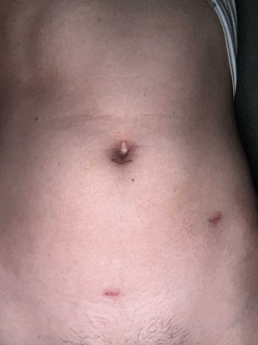 Ducky_boy tweet media