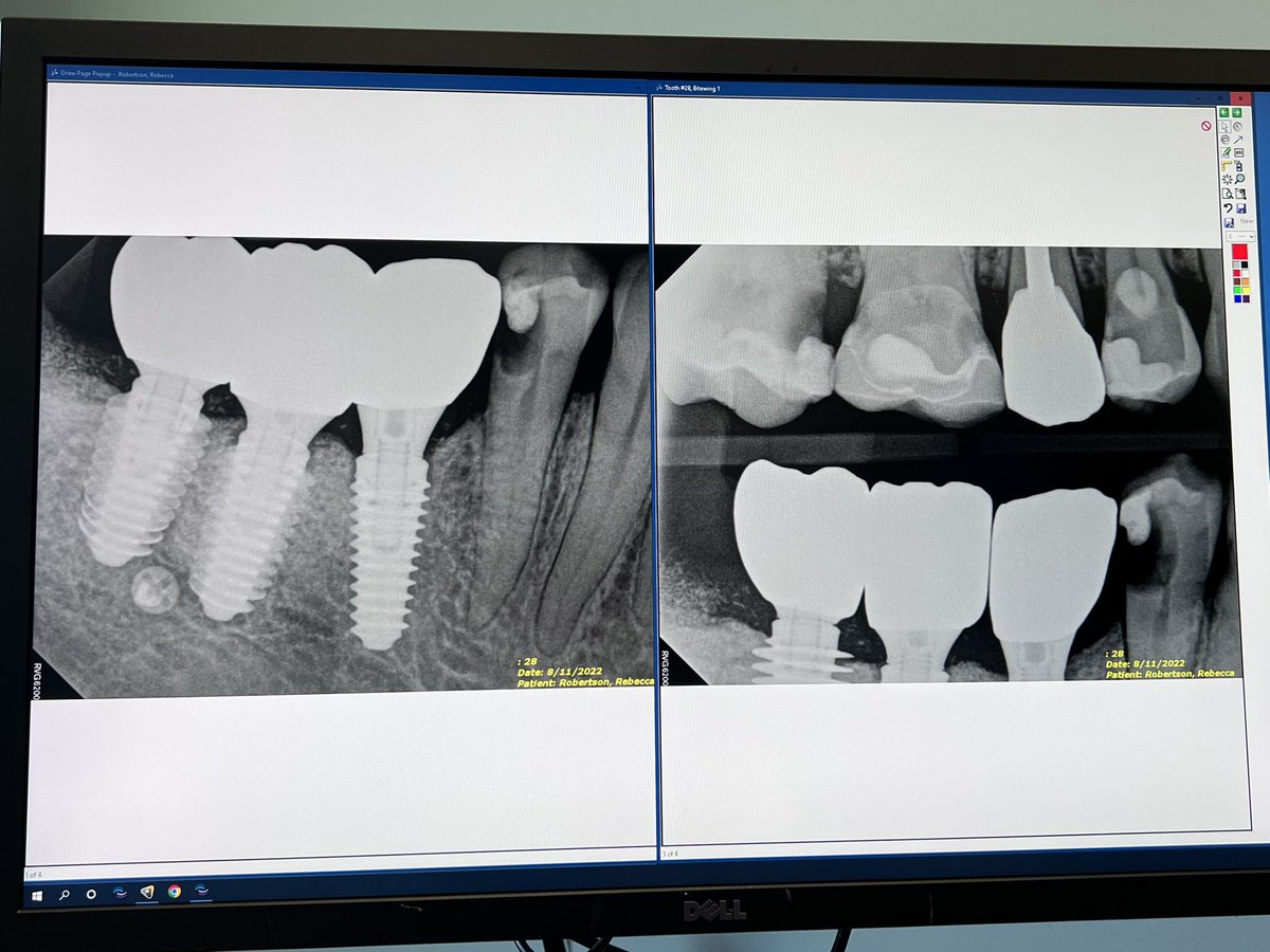 Becky Ancira Robertson tweet media